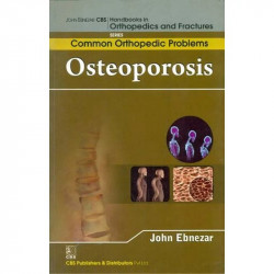 OSTEOPOROSIS (HANDBOOKS IN ORTHOPEDICS AND FRACTURES SERIES VOL 90 COMMON ORTHOPEDIC PROBLEMS (2012): Common Orthopedic Prob…