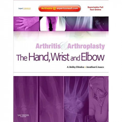 ARTHRITIS AND ARTHROPLASTY: THE HAND, WRIST AND ELBOW: EXPERT CONSULT - ONLINE, PRINT AND DVD book by Chhabra