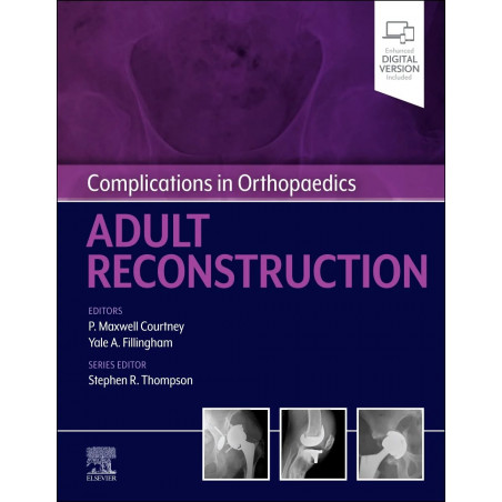 COMPLICATIONS IN ORTHOPAEDICS: ADULT RECONSTRUCTION, 1ST EDITION book by M.D. Courtney, P. Maxwell, M.D. Fillingham, Yale A.