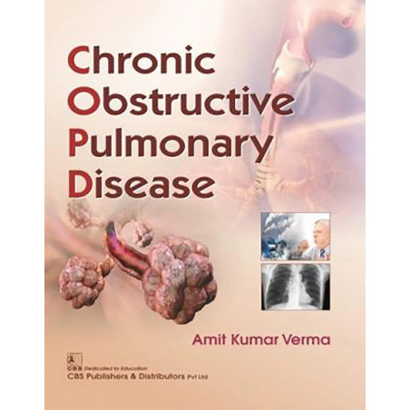 CHRONIC OBSTRUCTIVE PULMONARY DISEASE (PB 2019) book by VERMA A K