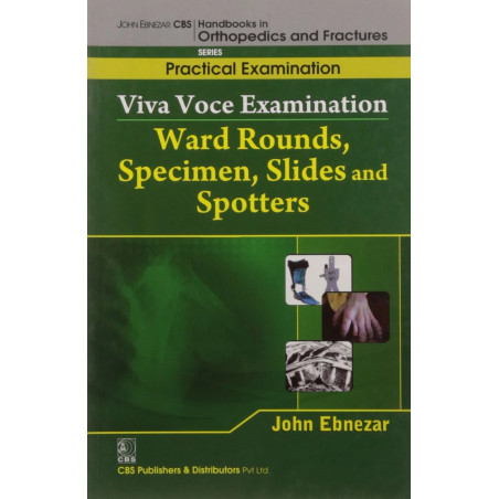 VIVA VOCE EXAMINATION WARD ROUNDS SPECIMEN SLIDES AND SPOTTERS(HANDBOOKS IN ORTHOPEDICS AND FRACTURES SERIES VOL 68 PRACTICA…