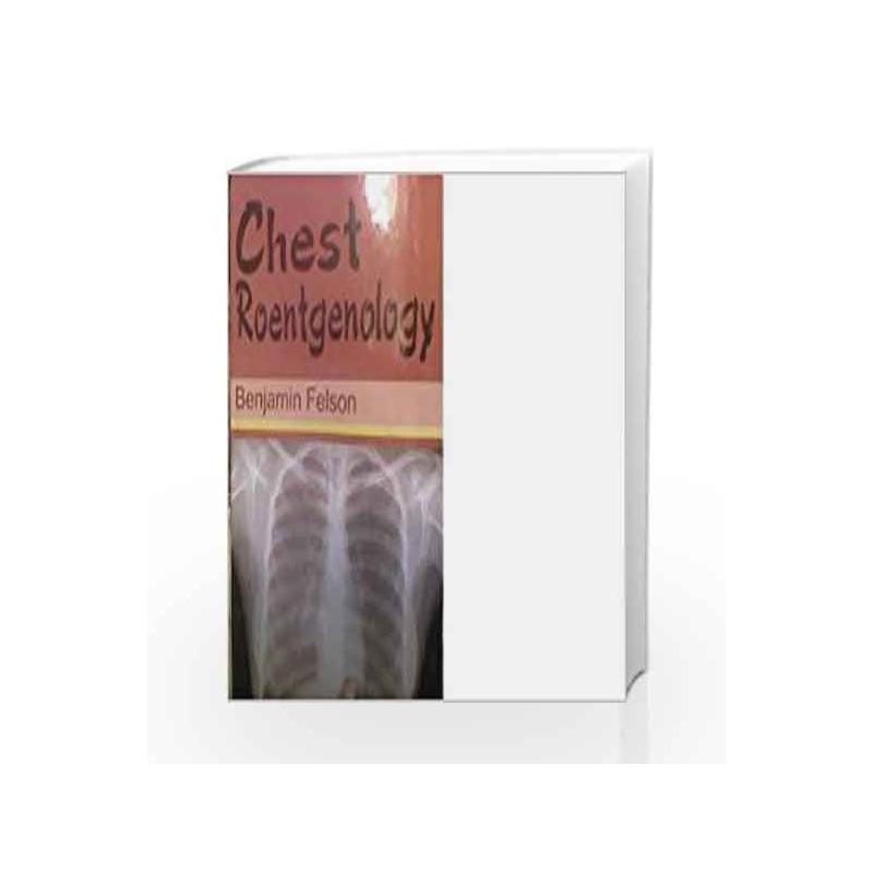 Chest Roentgenology by DR. YOGENDRA SINGH Book-9789374734872