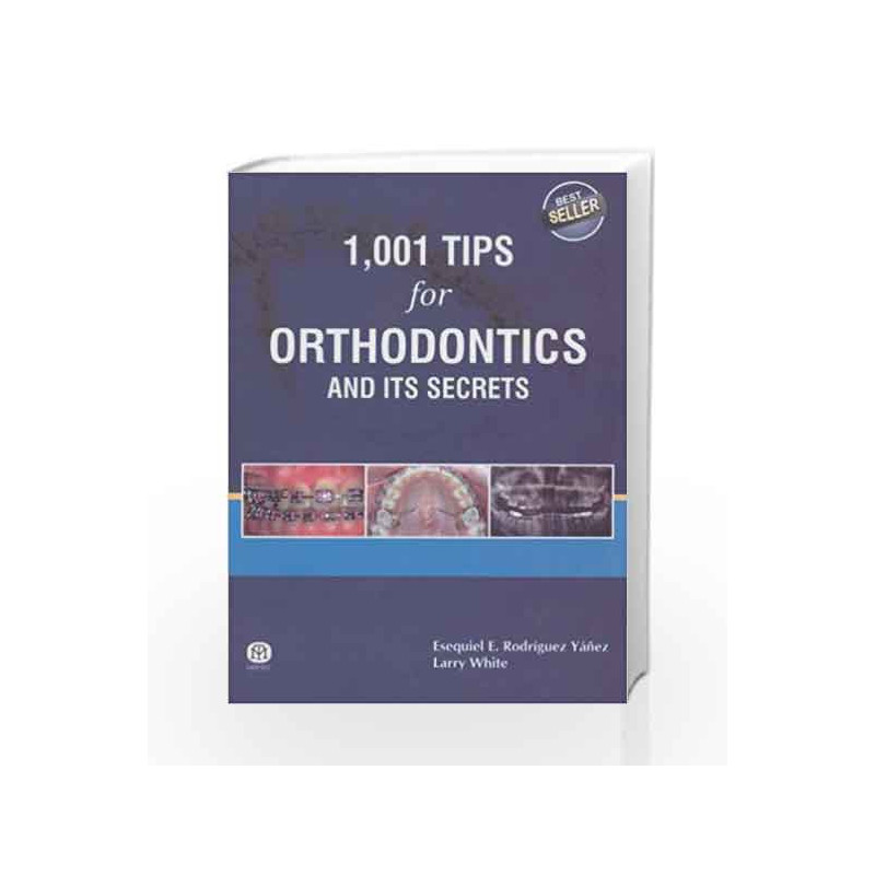 1,001 Tips For Orthodontics And Its Secrets by Esequiel E. Rodriguez Yanez Book-9789381714393