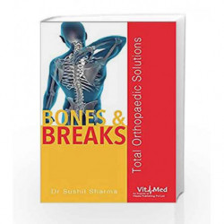 Bones & Breaks Total Orthopaedic Solutions by Dr Sushil Sharma Book-9789386473011