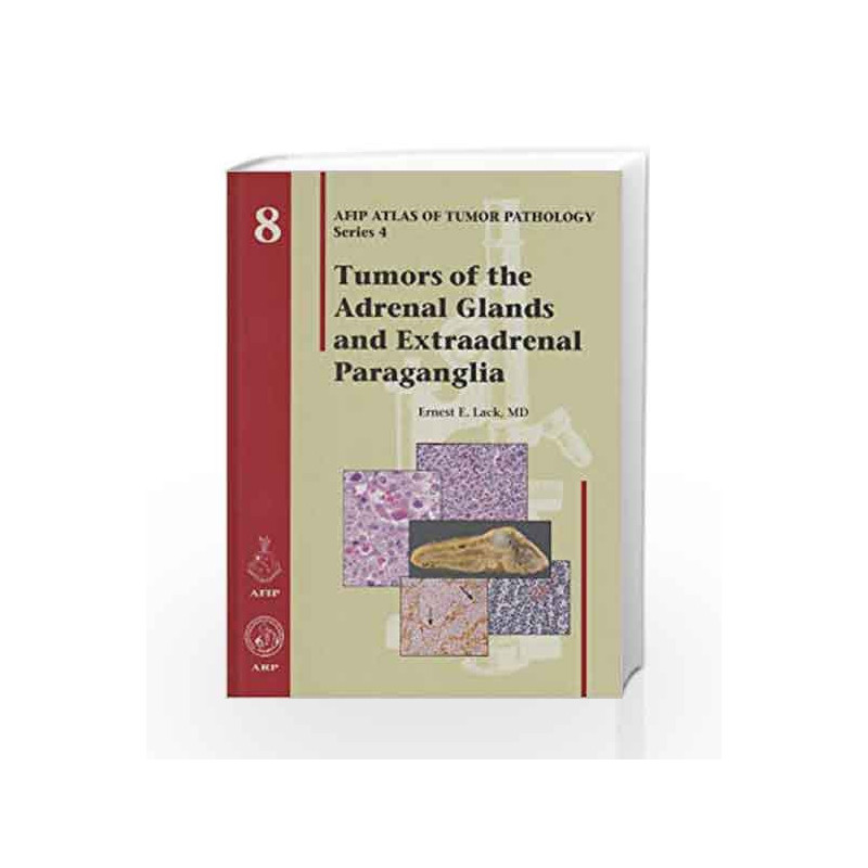 Tumors of the Adrenal Glands and Extraadrenal Paraganglia: 8 (Atlas of Tumor Pathology, Series 4,) by Lack E E Book-978188104101