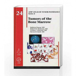 Tumors of the Bone Marrow (Atlas of Tumor Pathology, Series 4,) by Foucar K Book-9781933477350