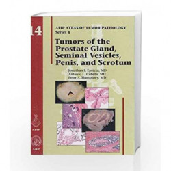 Tumors of the Prostate Gland, Seminal Vesicles, Penis, and Scrotum: 14 (Atlas of Tumor Pathology, Series 4,) by EpsteinJ.I. Book