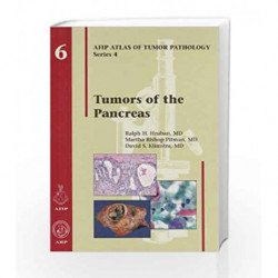 Tumors of the Pancreas (Atlas of Tumor Pathology, Series 4,) by Hruban R H Book-9781933477022