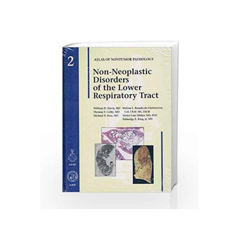 Non-Neoplastic Disorders of the Lower Respiratory Tract (Atlas of Non-Tumor Pathology, Series 1,) by Travis W D Book-97818810417