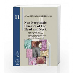 Non-Neoplastic Diseases of the Head and Neck (Atlas of Nontumor Pathology, Series 1, Number 11) by Wenig B.M. Book-9781933477374