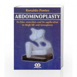Abdominoplasty: En Bloc Resection And Its Application In Thigh Lift And Torsoplasty by Pontes R. Book-9789588328188