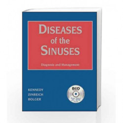 Diseases of the Sinuses: Diagnosis and Endoscopic Management by Kennedy Book-9781550090451