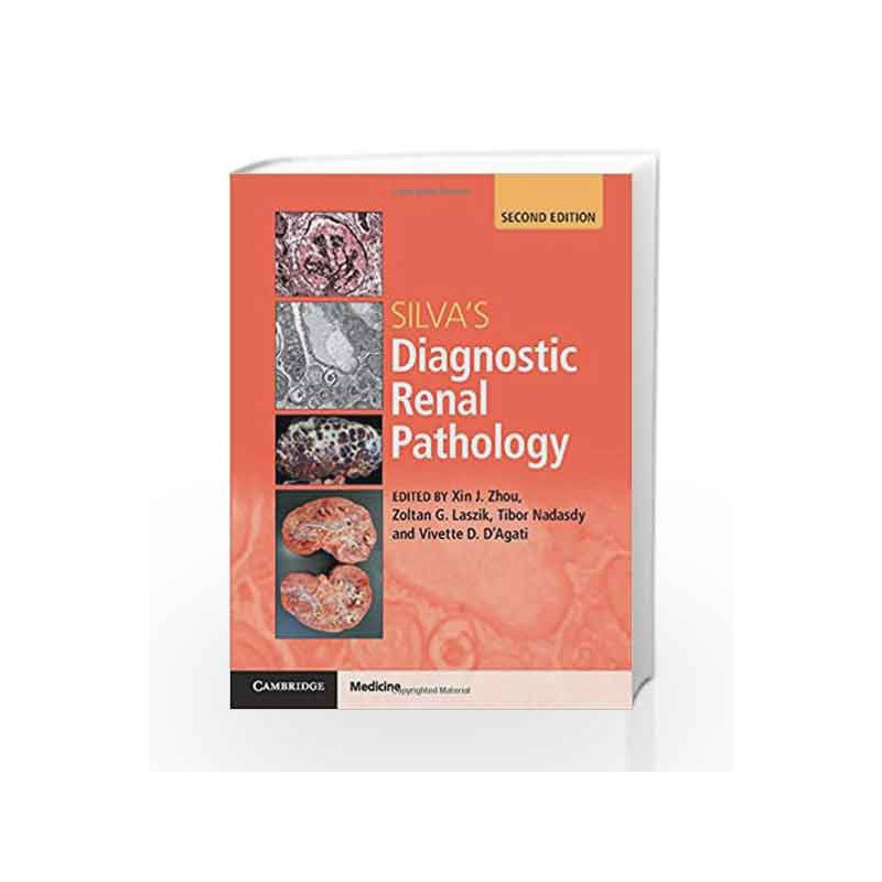 Silva's Diagnostic Renal Pathology by Jin X Book-9781316613986