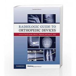 Radiologic Guide to Orthopedic Devices by Hunter T B Book-9781107085626