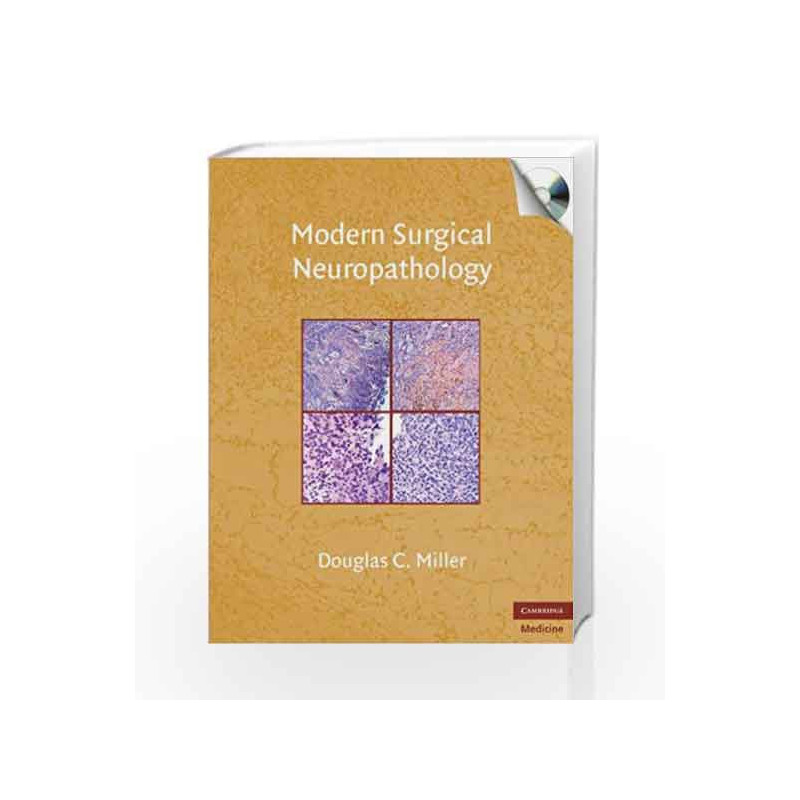 Modern Surgical Neuropathology with CD-ROM (Cambridge Medicine (Hardcover)) by Miller D.C. Book-9780521869324