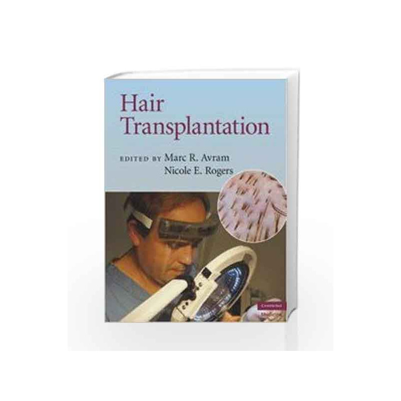 Hair Transplantation (Cambridge Medicine (Hardcover)) by Avram M R Book-9780521879675