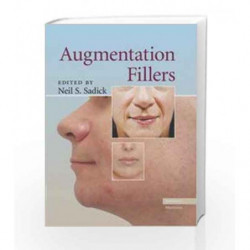 Augmentation Fillers by Sadick N.S. Book-9780521881128
