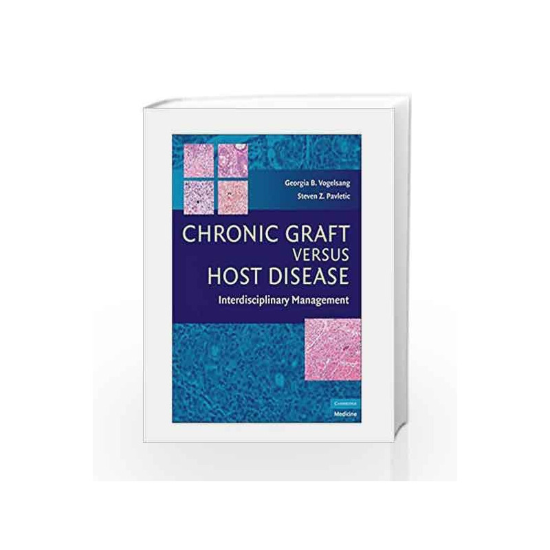 Chronic Graft Versus Host Disease: Interdisciplinary Management by Gogelsang G.B. Book-9780521884235