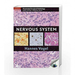 Nervous System (Cambridge Illustrated Surgical Pathology) by Vogel H. Book-9780521881616