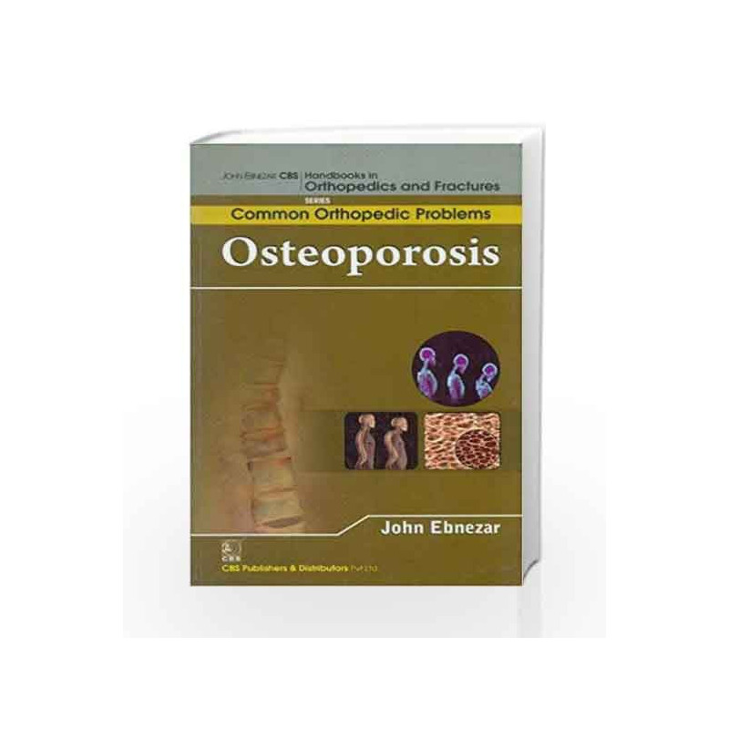 John Ebnezar CBS Handbooks in Orthopedics and Factures: Common Orthopedic Problems: Osteoporosis by Ebnezar J Book-9788123921709