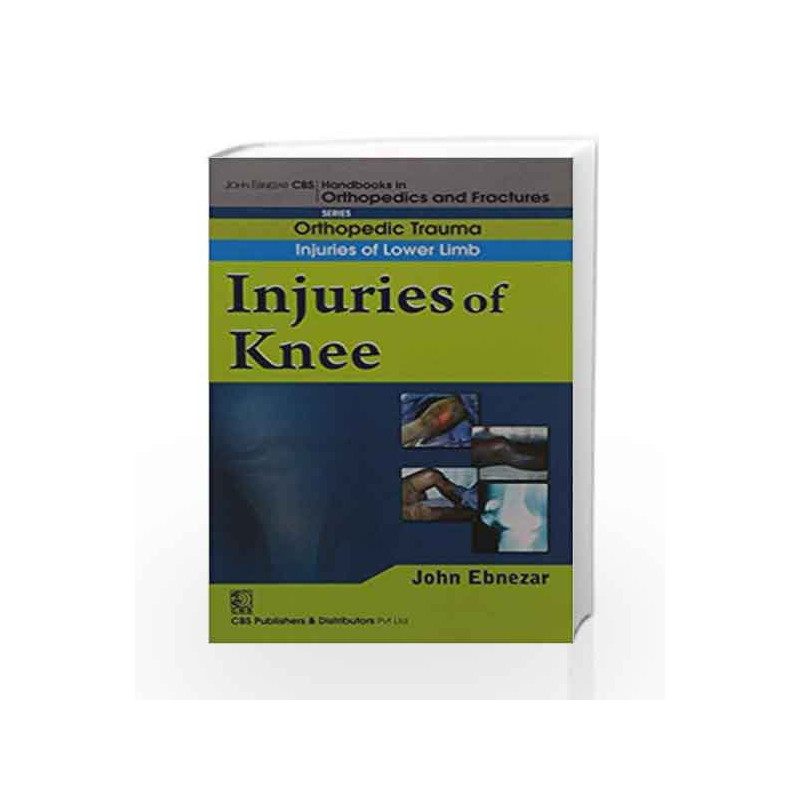 John Ebnezar CBS Handbooks in Orthopedics and Factures: Orthopedic Trauma: Injuries of Lower Limb: Injuries of Knee by Ebnezar J