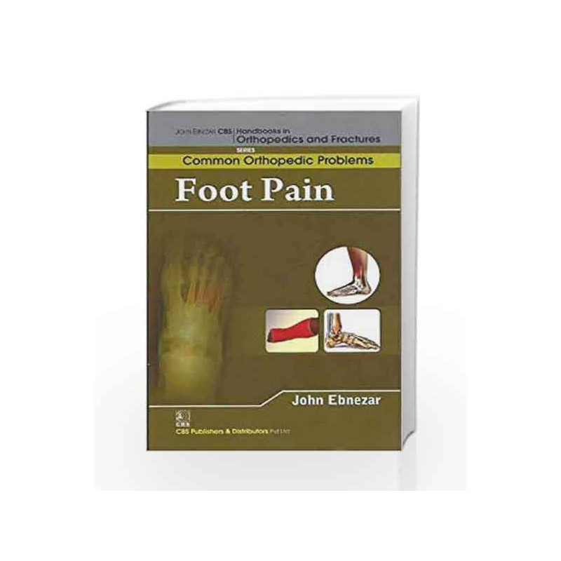 John Ebnezar CBS Handbooks in Orthopedics and Factures: Common Orthopedic Problems: Foot Pain by Ebnezar J. Book-9788123921716