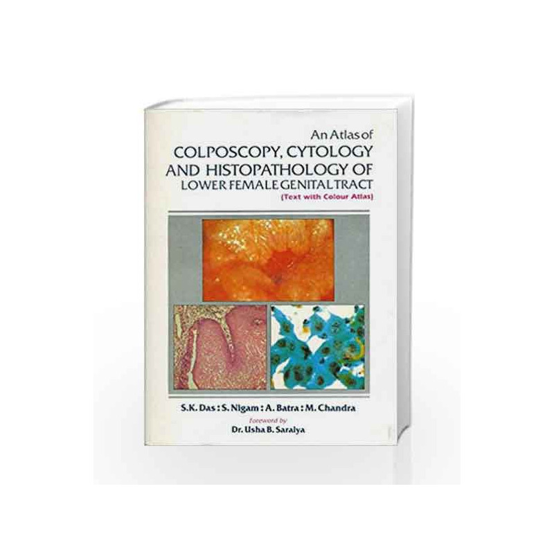 An Atlas of Colposcopy, Cytology and Histopathology of Lower Female Genital Tract (Text with Colour Atlas) by Das S Book-9788123