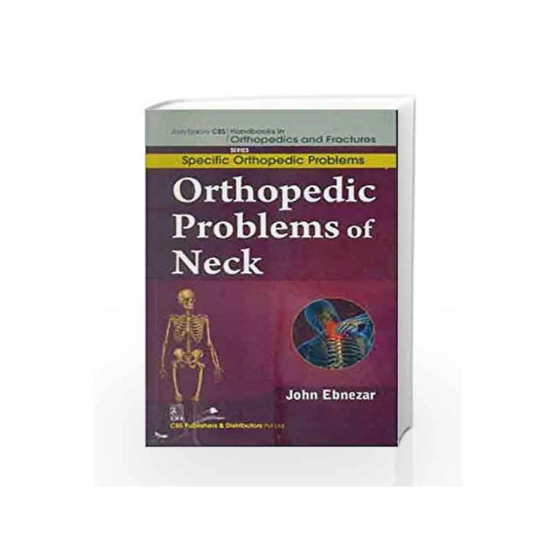 John Ebnezar CBS Handbooks in Orthopedics and Factures: Specific Orthopedic Problems: Orthopedic Problems of Neck by Ebnezar J. 