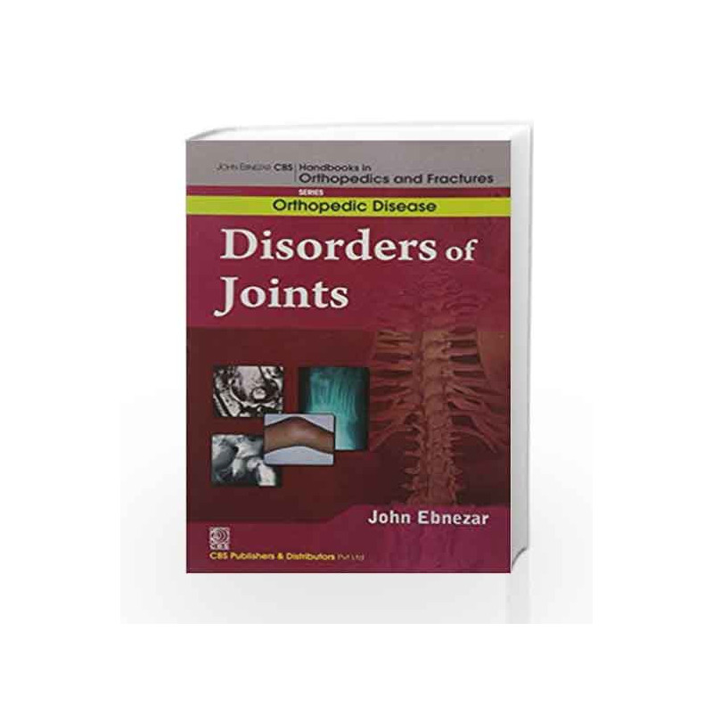 John Ebnezar CBS Handbooks in Orthopedics and Factures: Orthopedic Disease: Disorders of the Joints by Ebnezar J. Book-978812392