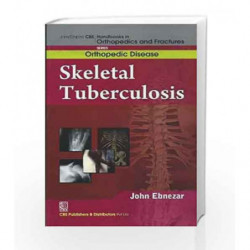 John Ebnezar CBS Handbooks in Orthopedics and Factures: Orthopedic Disease: Skeletal Tuberculosis by Ebnezar J. Book-97881239211
