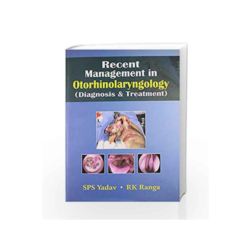 Recent Management in Otorhinolaryngology (Diagnoosis and Treatment) by Yadav Sps Book-9788123920498