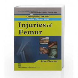 John Ebnezar CBS Handbooks in Orthopedics and Factures: Orthopedic Trauma: Injuries of Lower Limb: Injuries of Femur by Ebnezar 