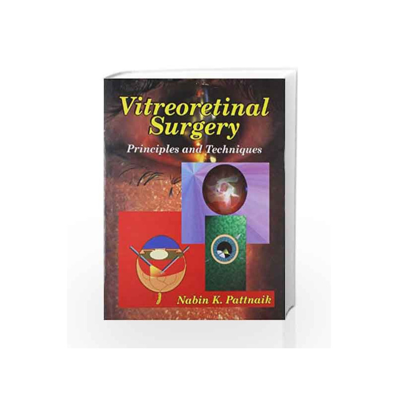Vitreoretinal Surgery: Prin. and Techniques by Pattnaik N.K Book-9788123909561