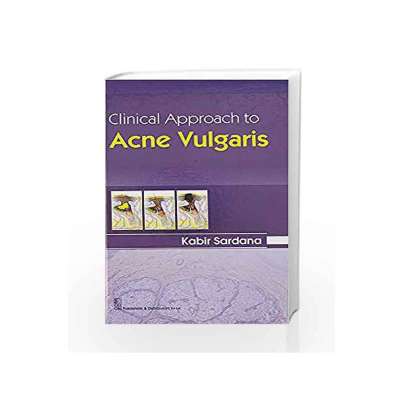 Clinical Approach to Acne Vulgaris by Sardana K. Book-9788123928357
