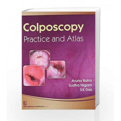Colposcopy: Practice and Atlas by Batra Book-9788123924038