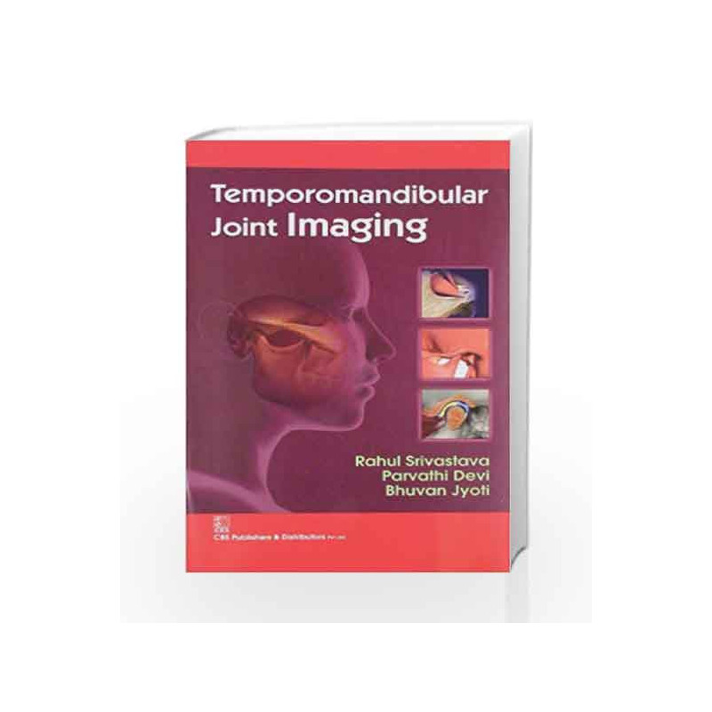 Temporomandibular Joint Imaging by Srivastava R. Book-9788123923970