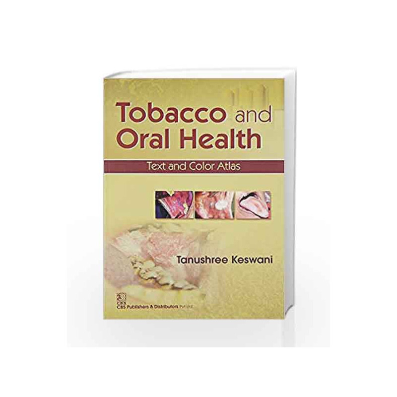 Tobacco And Oral Health Text And Color Atlas (Pb 2016) by Keswani T. Book-9788123928593