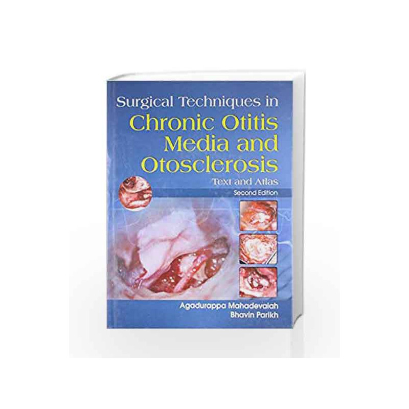 Surgical Techniques in Chronic Otitis Media and Otosclerosis: Text and Atlas by Mahadevaiah Book-9788123919737