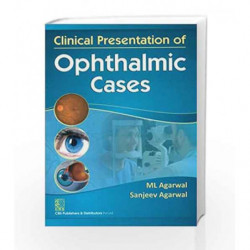 Clinical Presentation of Ophthalmic Cases by Agarwal M.L. Book-9788123922935