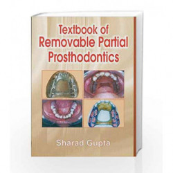 Textbook of Removable Partial Prosthodontics by Gupta S Book-9788123917214
