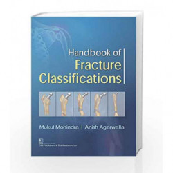 HANDBOOK OF FRACTURE CLASSIFICATIONS by Mohindra M Book-9789386478412
