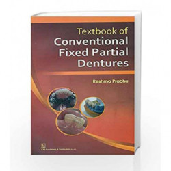 Textbook of Conventional Fixed Partial Dentures by Prabhu R. Book-9788123923604