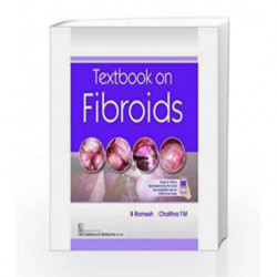 TEXTBOOK ON FIBROIDS (PB 2018) by Ramesh B Book-