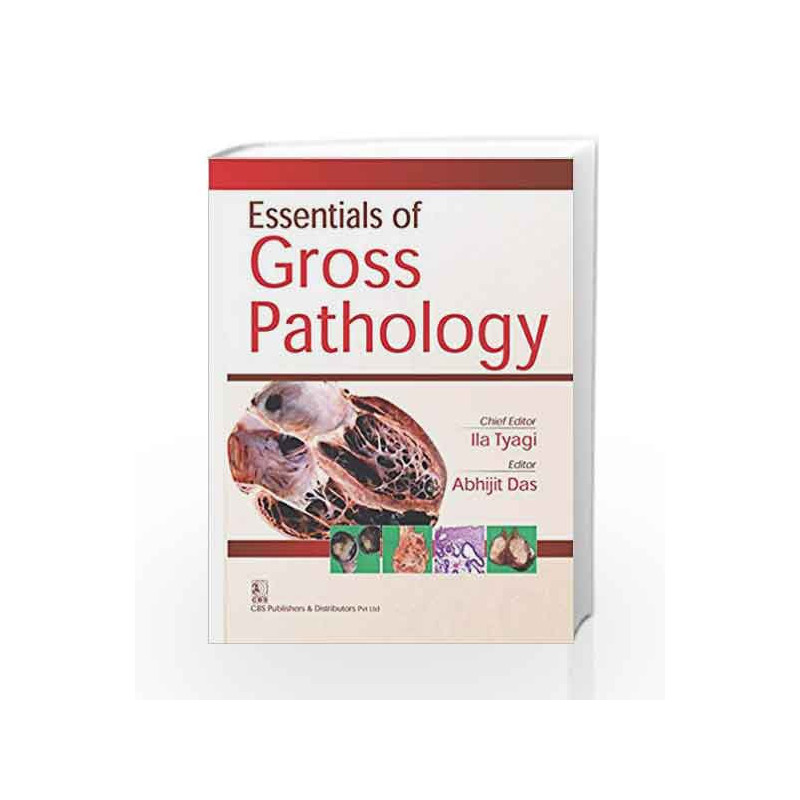 Essentials Of Gross Pathology (Pb 2017) by Tyagi Book-9789386217523