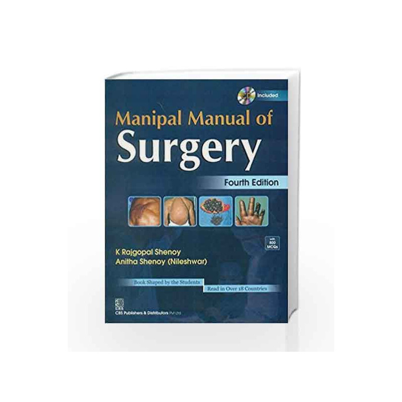 Manipal Manual of Surgery by Shenoy K. R Book-9788123924168