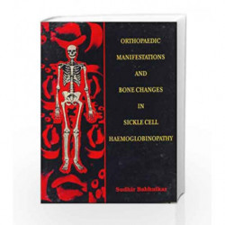 Orthopaedic Manifestations and Bone Changes in Sickle Cell Haemoglobinopathy: 0 by Babhulkar S. Book-9788123905778