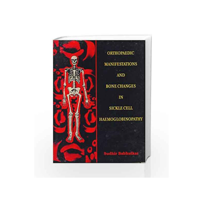Orthopaedic Manifestations and Bone Changes in Sickle Cell Haemoglobinopathy: 0 by Babhulkar S. Book-9788123905778
