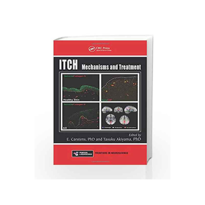 Itch: Mechanisms and Treatment (Frontiers in Neuroscience) by Carstens Book-9781466505438