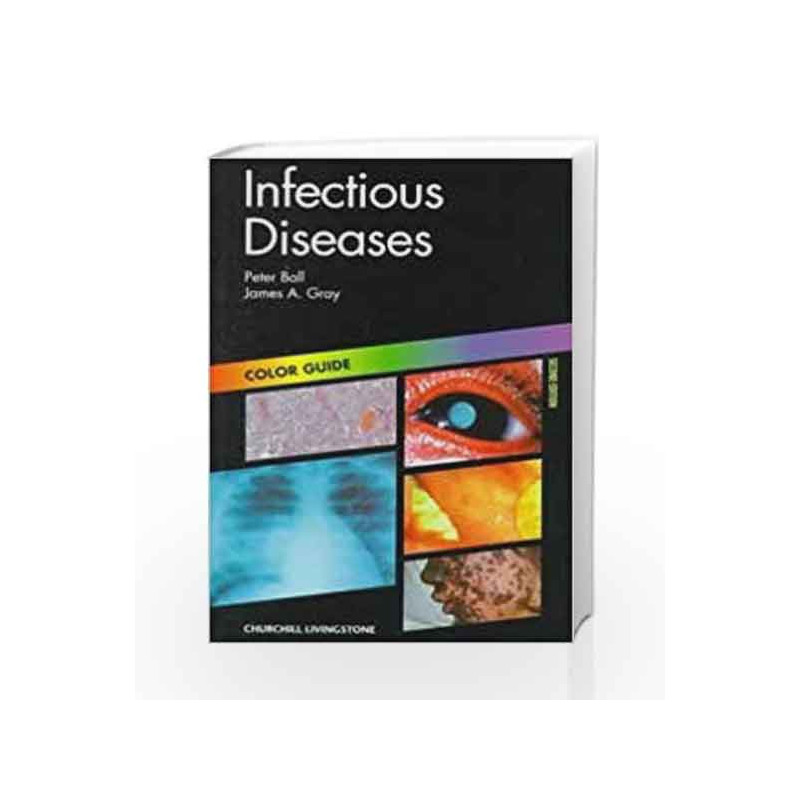 Infectious Diseases (Colour Guides) by Peter B Book-9780443058837