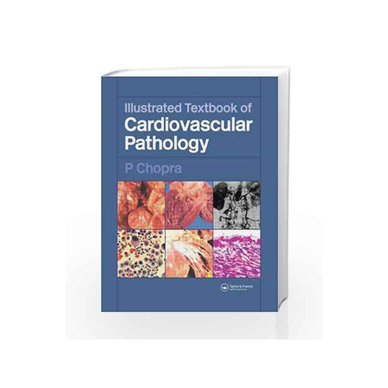 Illustrated Textbook of Cardiovascular Pathology by Chopra Book-9781841844510